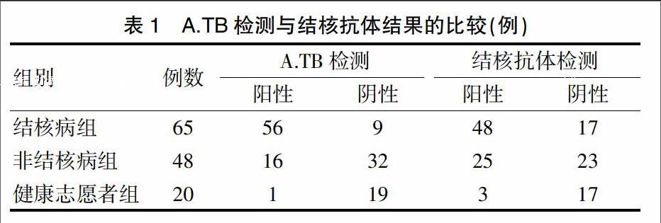 结核杆菌特异性细胞免疫反应检测(酶联免疫法)临床应用探讨