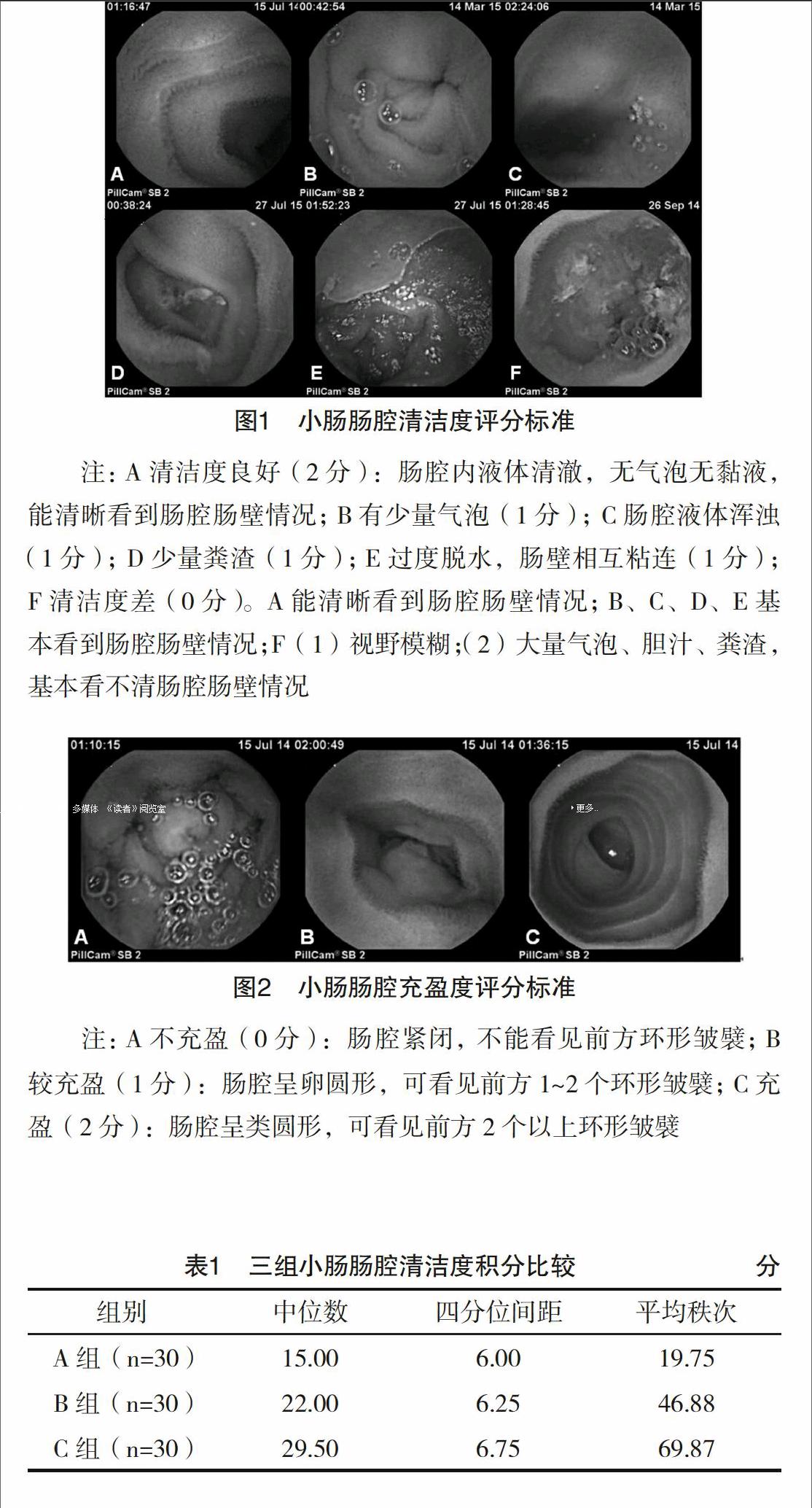 复方聚乙二醇序贯甘露醇改进胶囊内镜肠道准备