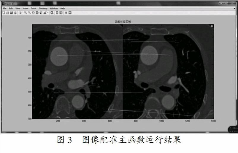 基于matlab的医学图像配准实验