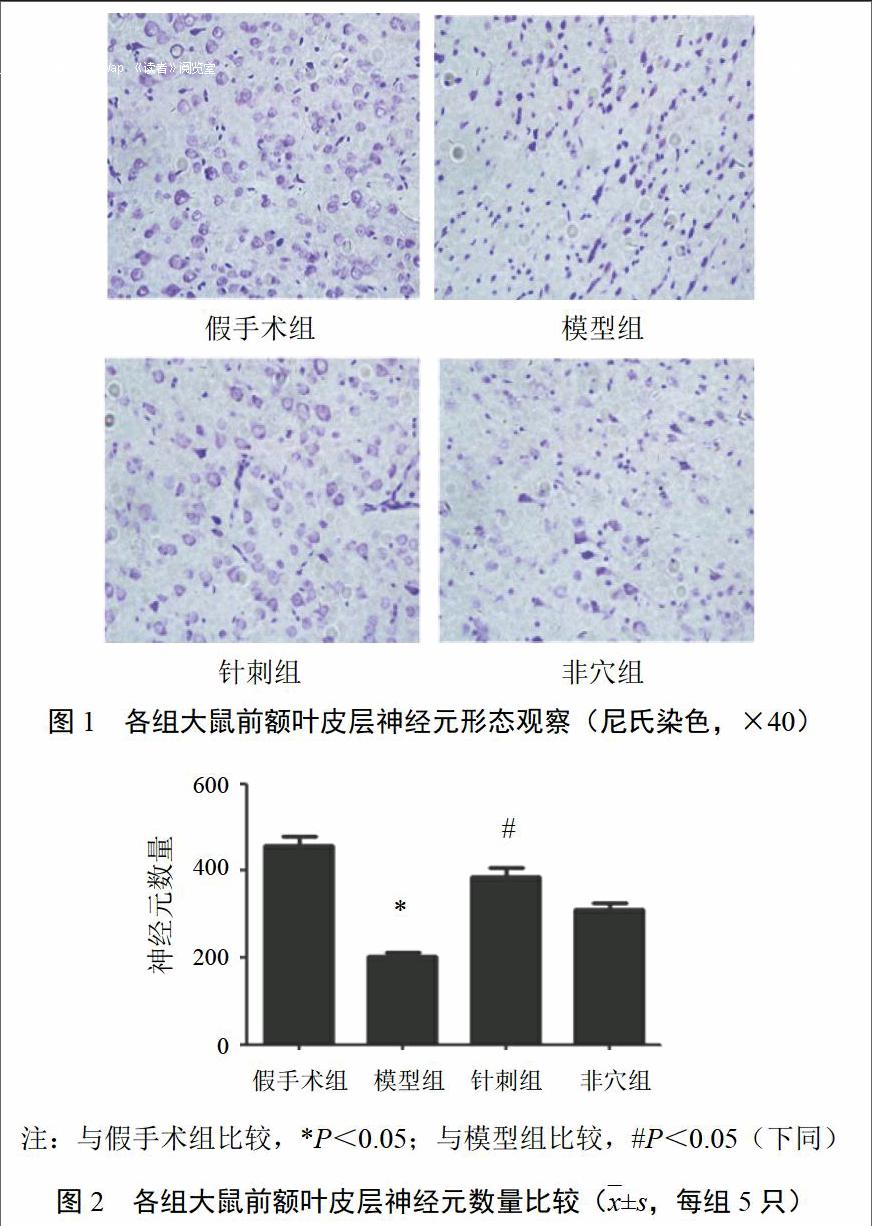 针刺对血管性痴呆大鼠前额叶皮层氧化应激及神经元损伤的影响