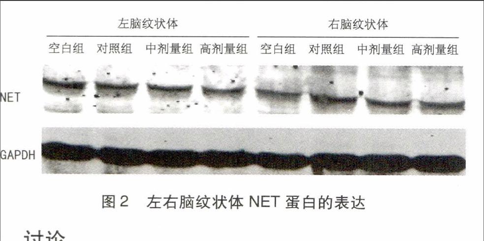 龙牡桂枝汤对adhd模型大鼠左右额叶一纹状体去甲肾上腺素转运体蛋白