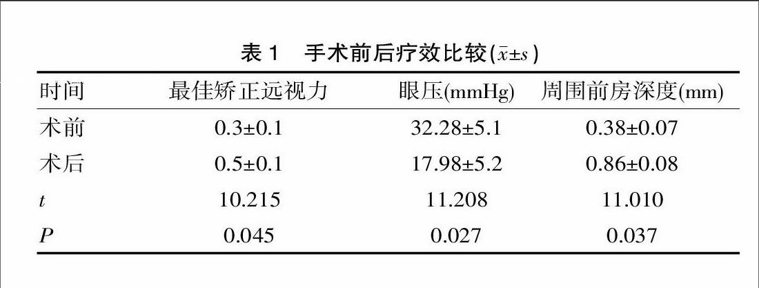 ahmde青光眼引流阀治疗新生血管性青光眼的临床疗效探讨