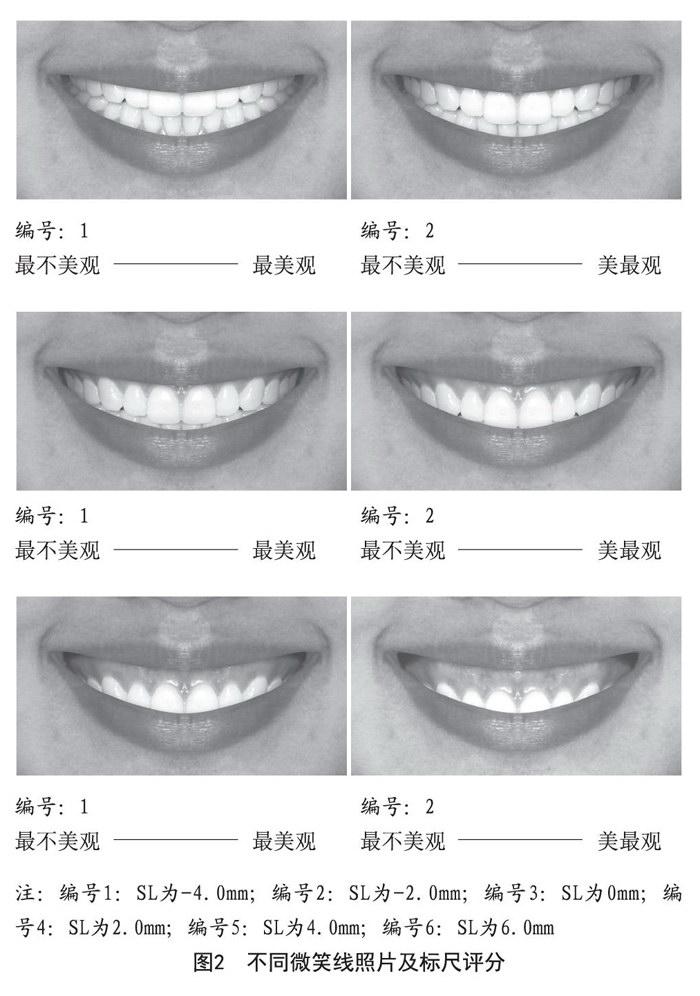 口腔正畸医师与普通人微笑线美学观点差异性调查分析