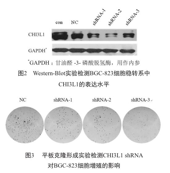 人几丁质酶-3样蛋白-1在人胃癌细胞中的表达及其对人胃癌细胞增殖和