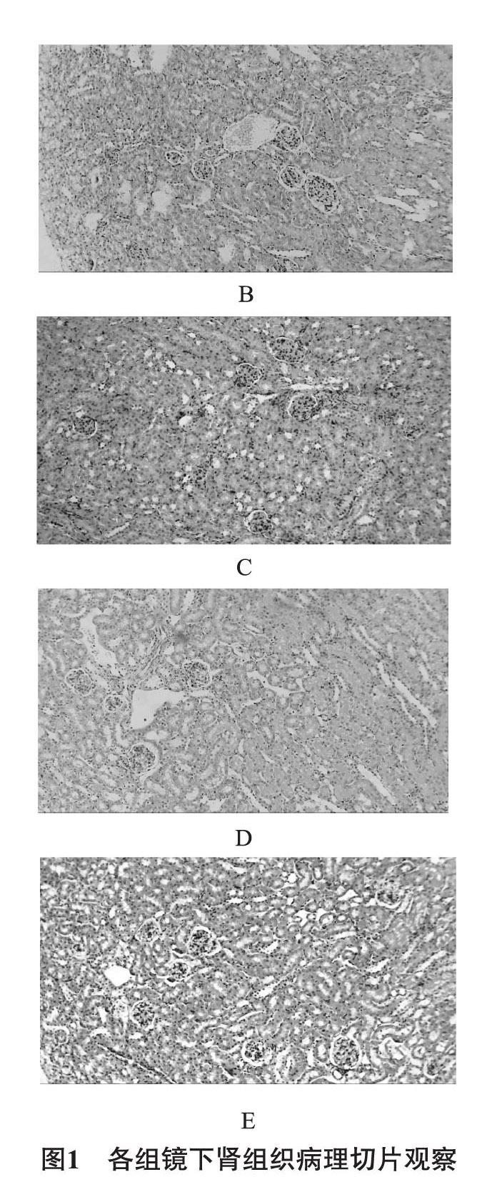 中,高剂量组,2周后处死小鼠,肾石蜡切片,he染色,检测肾组织匀浆中超