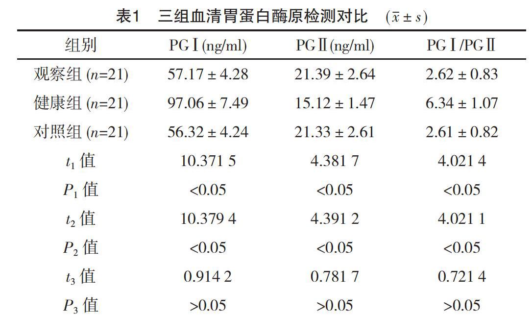 血清胃蛋白酶原联合靛胭脂染色诊断早期胃癌的价值分析