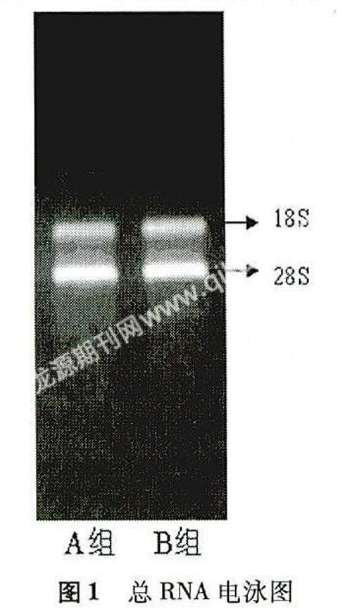 1 股静脉组织的总rna提取及电泳图 各组股静脉组织总rna的od260/od280