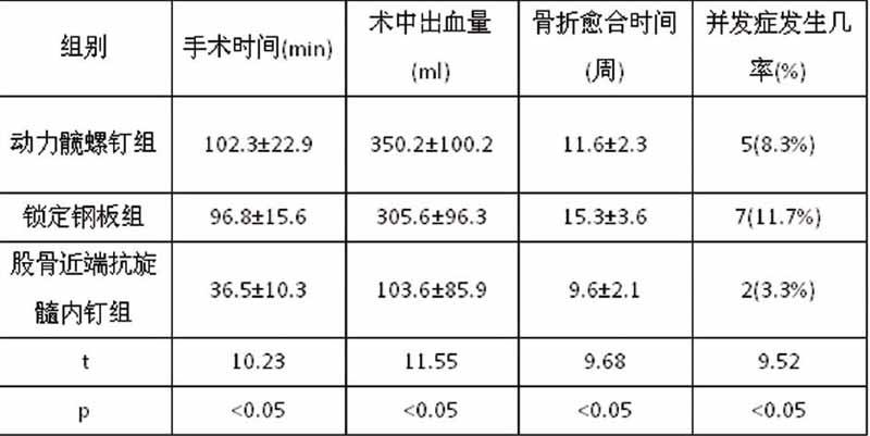 3种内固定治疗股骨粗隆间骨折疗效对比