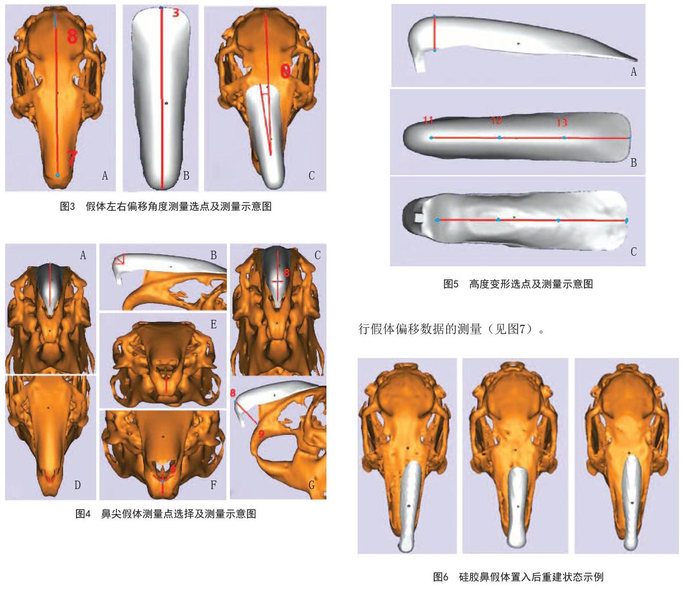 应用三维ct扫描重建技术对假体隆鼻术后位移精确测量的方法探讨