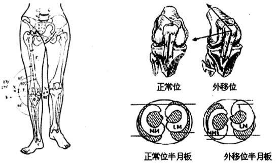 楊式太極拳演習者髕骨外移現象及其糾正