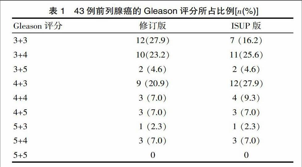 国际泌尿病理协会gleason评分系统对前列腺癌分级的影响