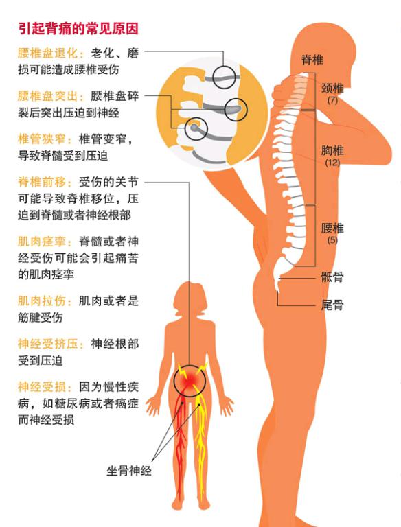肠癌背疼位置图片图片