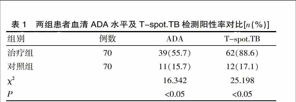 血清ada水平和t Spot Tb联合检测在肺结核诊断中的应用 参考网