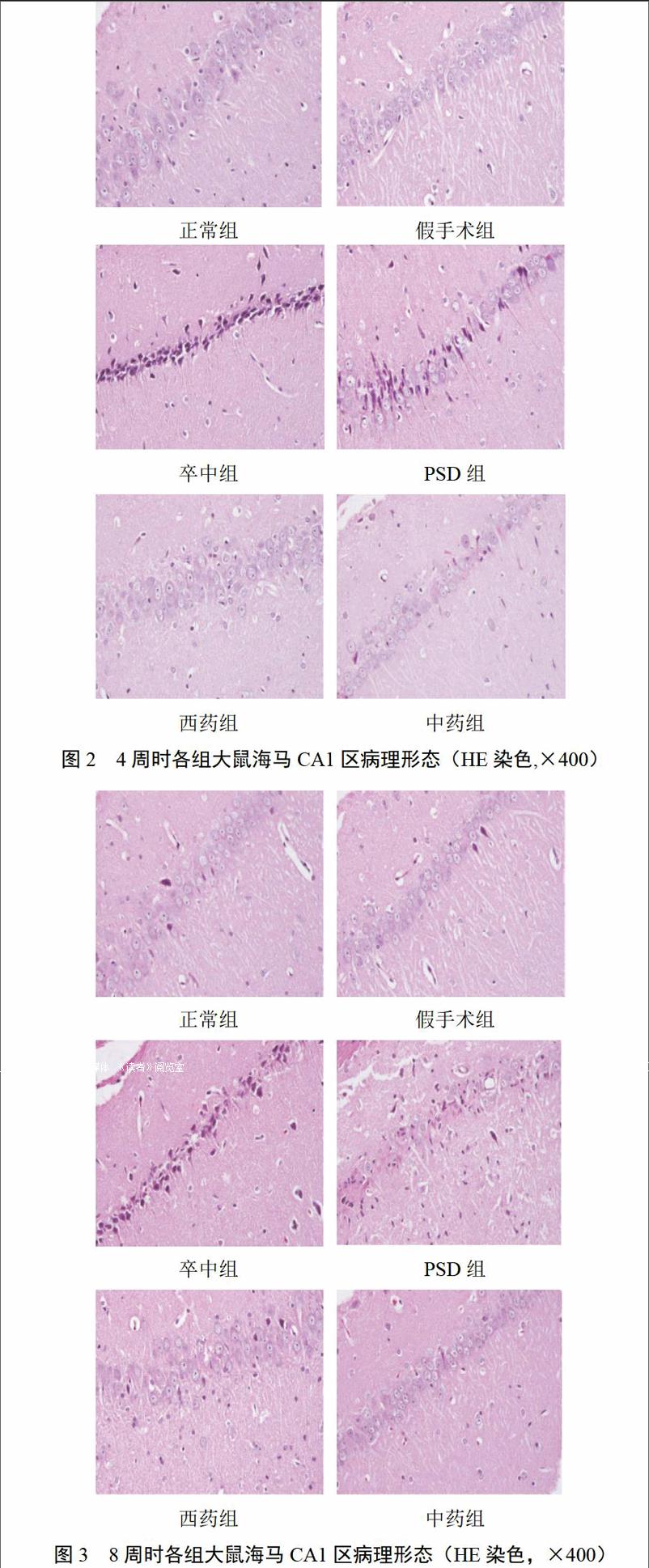 頤腦解鬱複方對卒中後抑鬱大鼠行為學及海馬ca1區病理損傷的影響