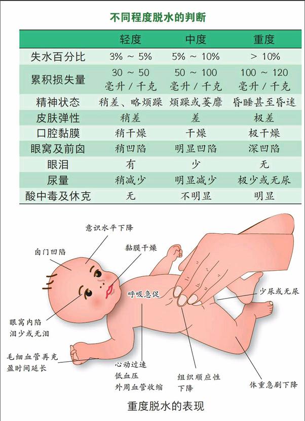 宝宝腹泻,警惕脱水