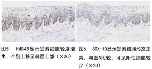 甲母细胞图片
