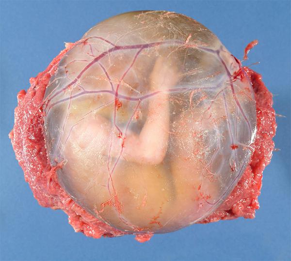 人胎盘图片人体图片