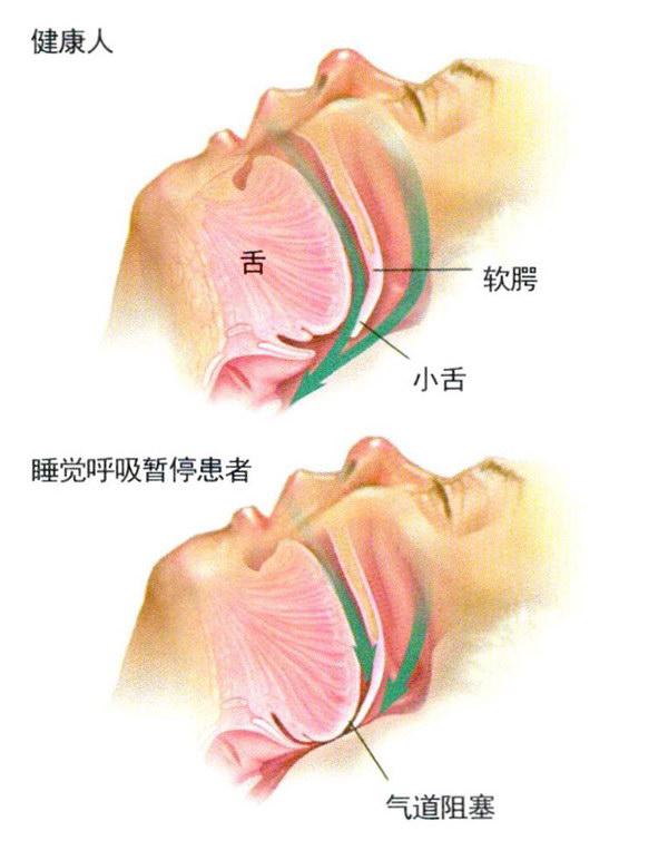 人腮的正确位置图片图片