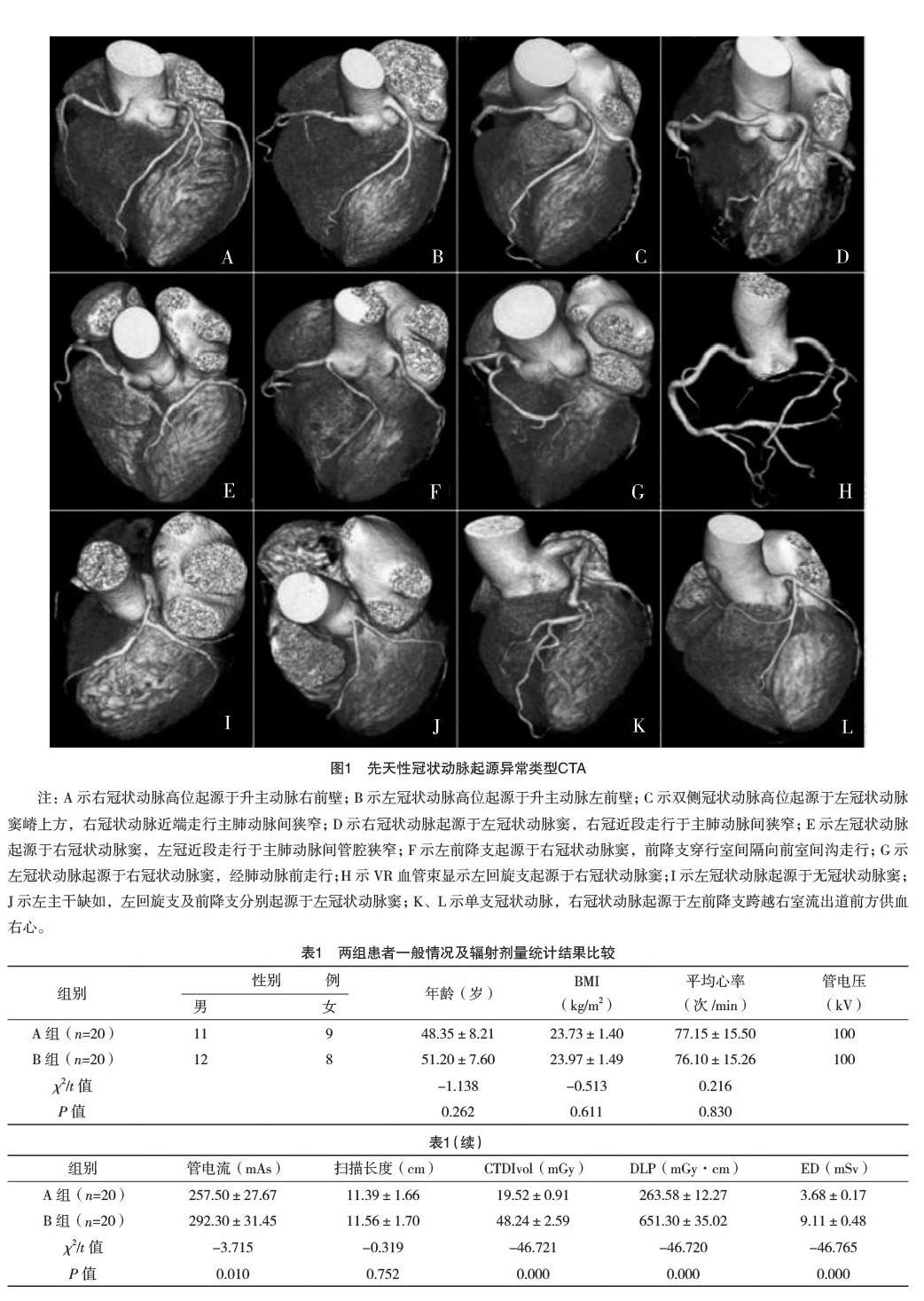 雙源ct在先天性冠狀動脈起源異常的臨床應用