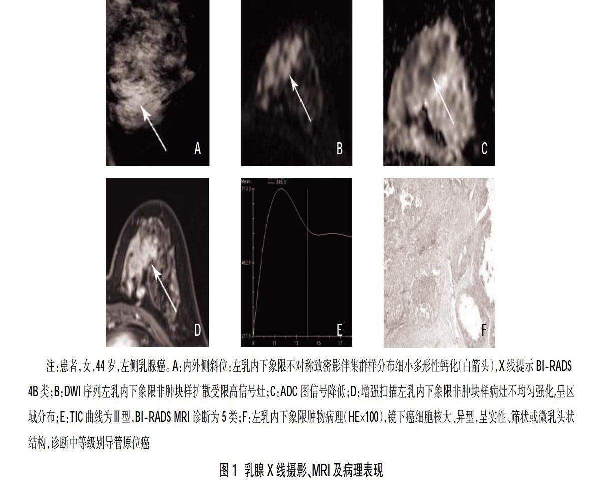 Aurora Dedicated Breast MRI Scanner - Model Information