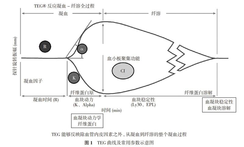 乐普血栓弹力图图片