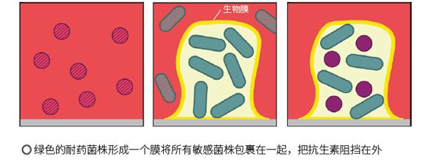 撐起生物膜