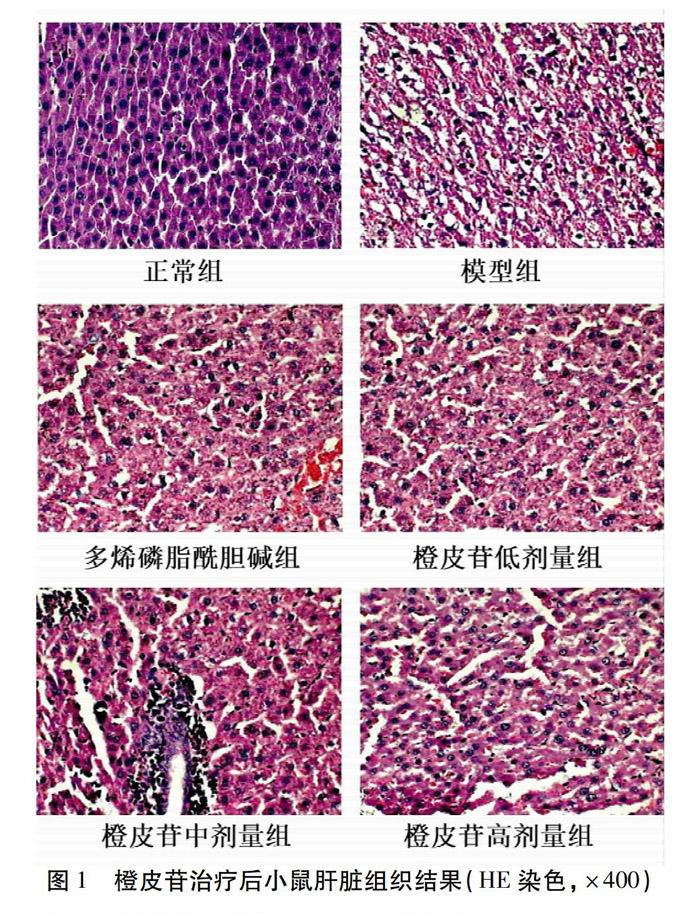 橙皮苷结晶显微图图片