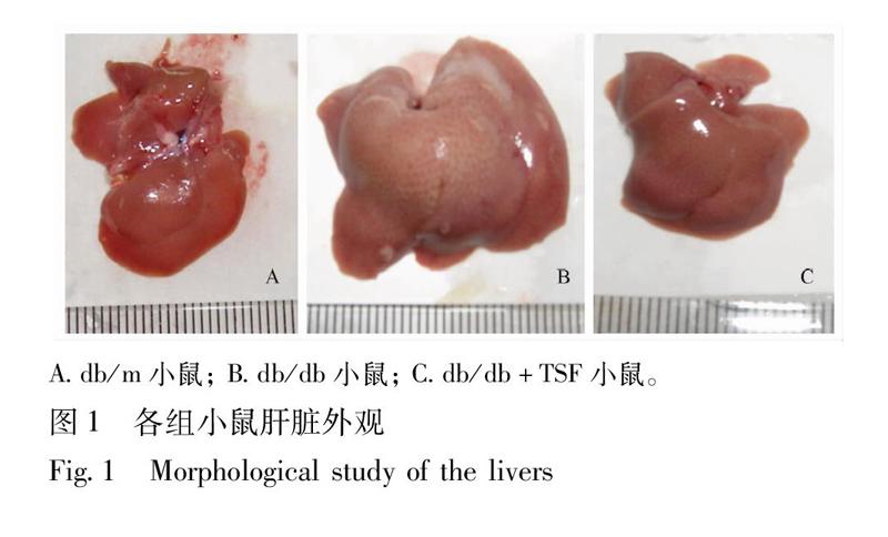 糖肾方改善db/db小鼠脂代谢紊乱与巨噬细胞活化分型的实验研究