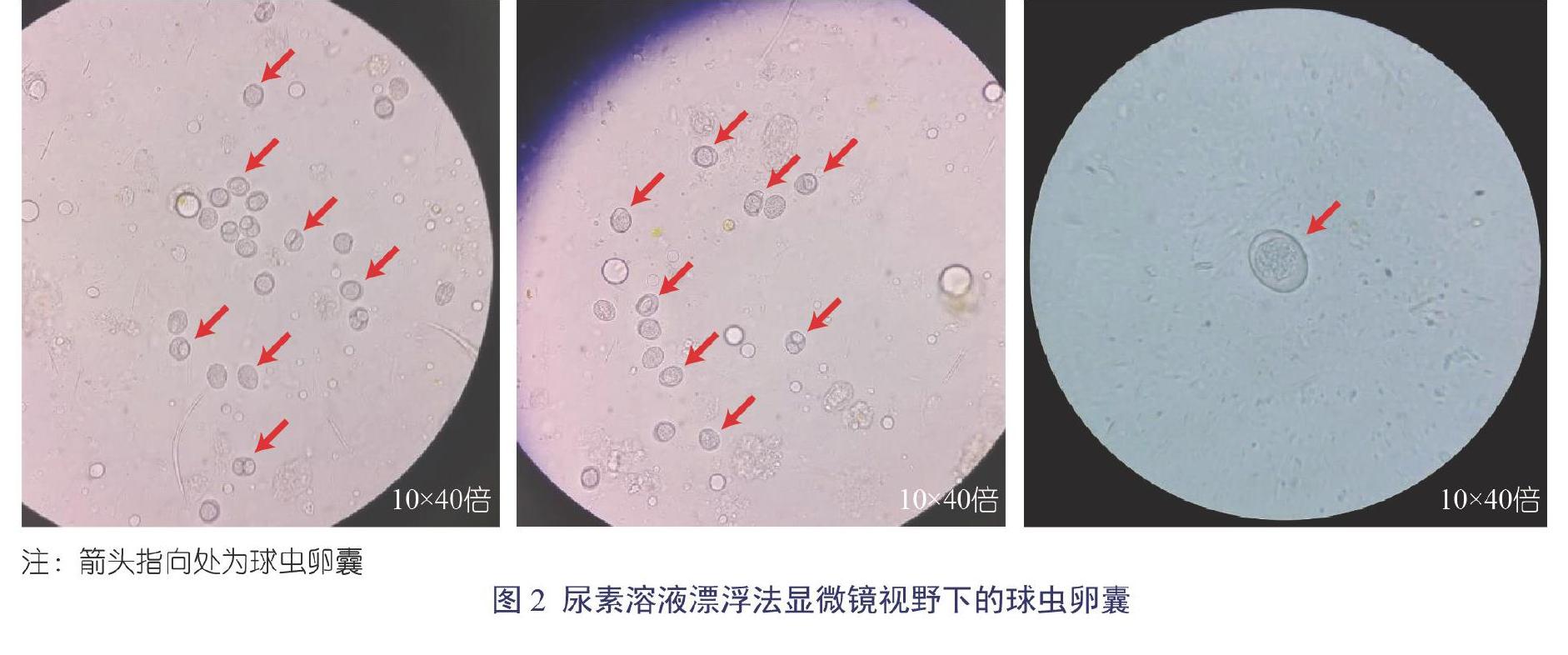 显微镜下球虫图片