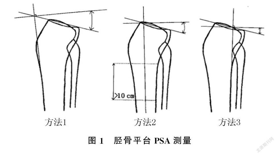 胫骨后倾角图片