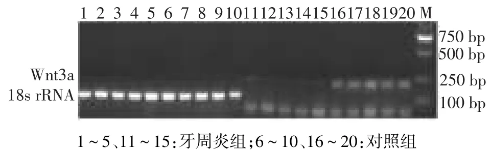 Wnt3a在慢性牙周炎中的表达及临床意义_参考网