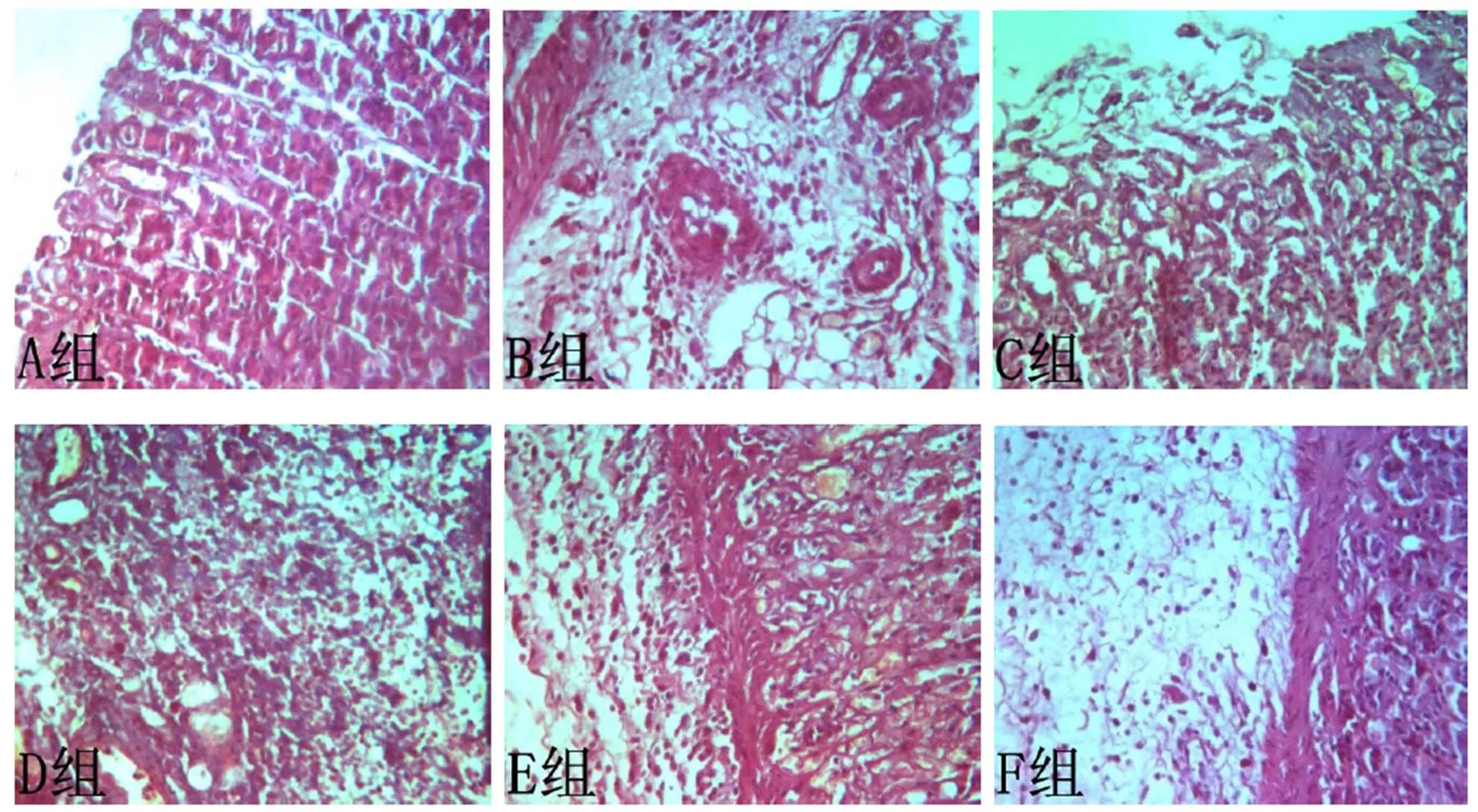 艾灸、电针足三里对腓总神经横断术后大鼠胃黏膜损伤修复的影响参考网